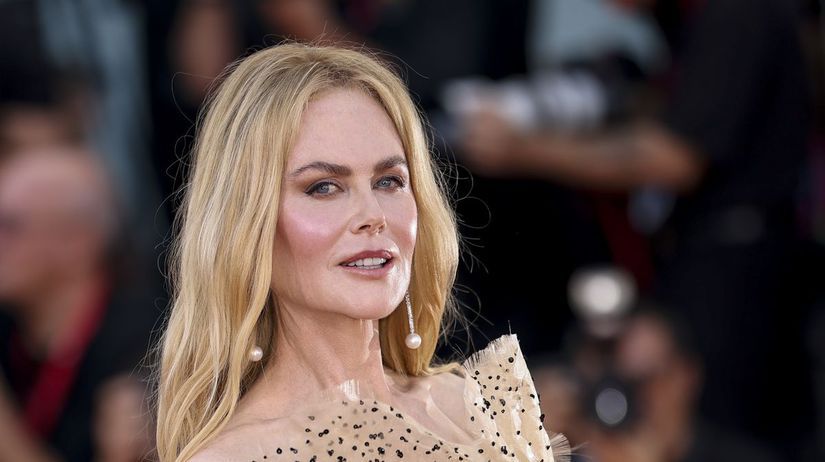 Herecka Nicole Kidman pristihnuta bez pudru Su toto jej skutocne vlasy