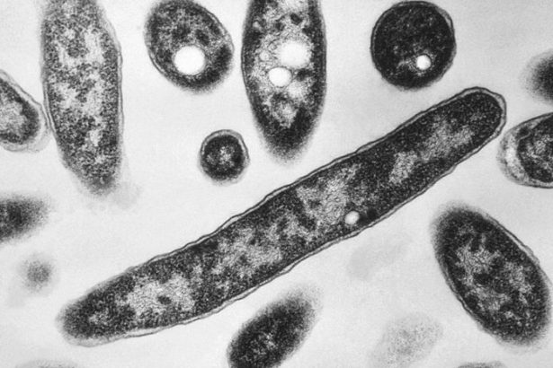 V hotelovej virivke v Demanovskej Doline potvrdili bakteriu Legionella