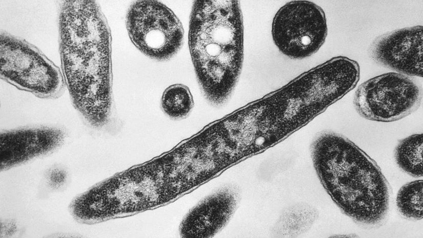 V hotelovej virivke v Demanovskej Doline potvrdili bakteriu Legionella