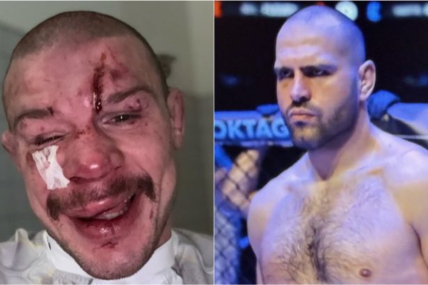 Krvavy prazsky kupel pre Slovakov Princ bratislavsky schytal vyprask necakany knokaut pre Budaya