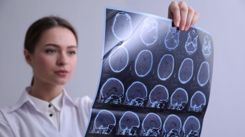 Zapal mozgu je minulostou Tuto jednoduchu a pritom prelomovu metodu pozna len malokto